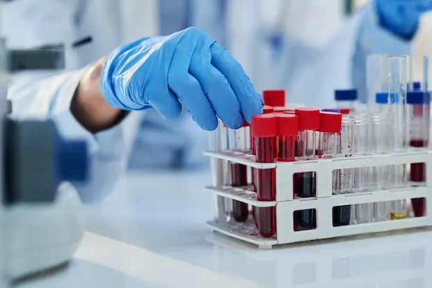 Pathology lab with blood samples